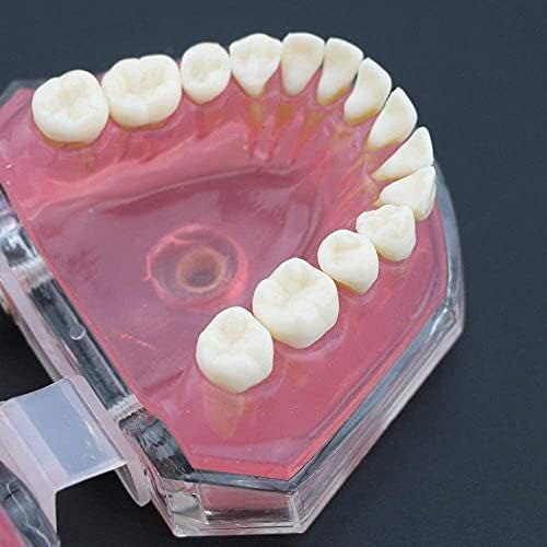 Модел на човешки орган NIANXINN стандартния модел LMEILI Стоматологичен с Подвижни зъби Стоматологично Изследване на Обучение Модел на Зъбите Модел на Здравно орган