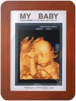 Рамка за снимка с Сонограммой Дете, Ултразвукова Фоторамка Реклама за бременност, Рамка за Снимка с Сонограммой, Неутрален