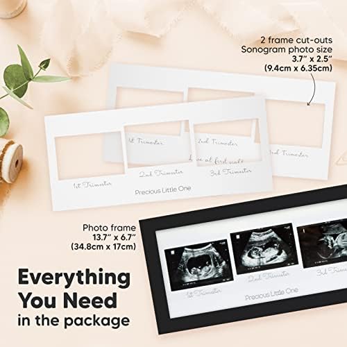 Рамка за сонограммы - Три Ултразвукови рамки за снимки за подарък на бъдещата майка - Рамка за ЕХОГРАФИЯ на детето -