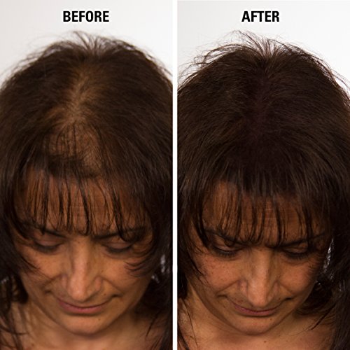 Infinity Hair Fiber - Лек от Загуба на коса - Влакна за Сгъстяване на косата при мъже и жени - Тъмно-кафяви, 15 г